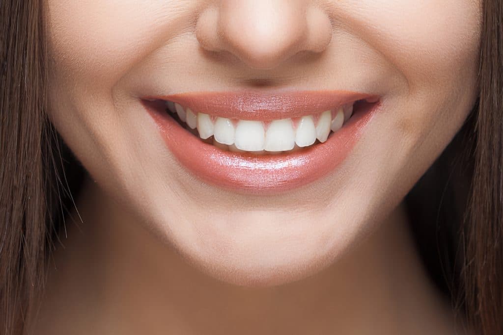 2 Options for Whitening Your Teeth | Embrace Orthodontics