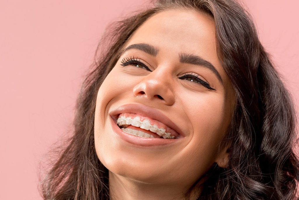 Adult Braces: Are They Right for You?