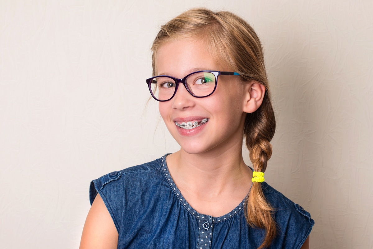 Are damon braces more comfortable than metal braces blog