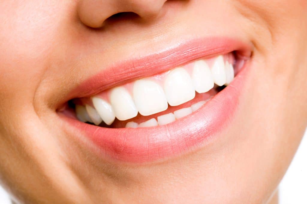 How Long Does It Take To Whiten Teeth? | Embrace Orthodontics