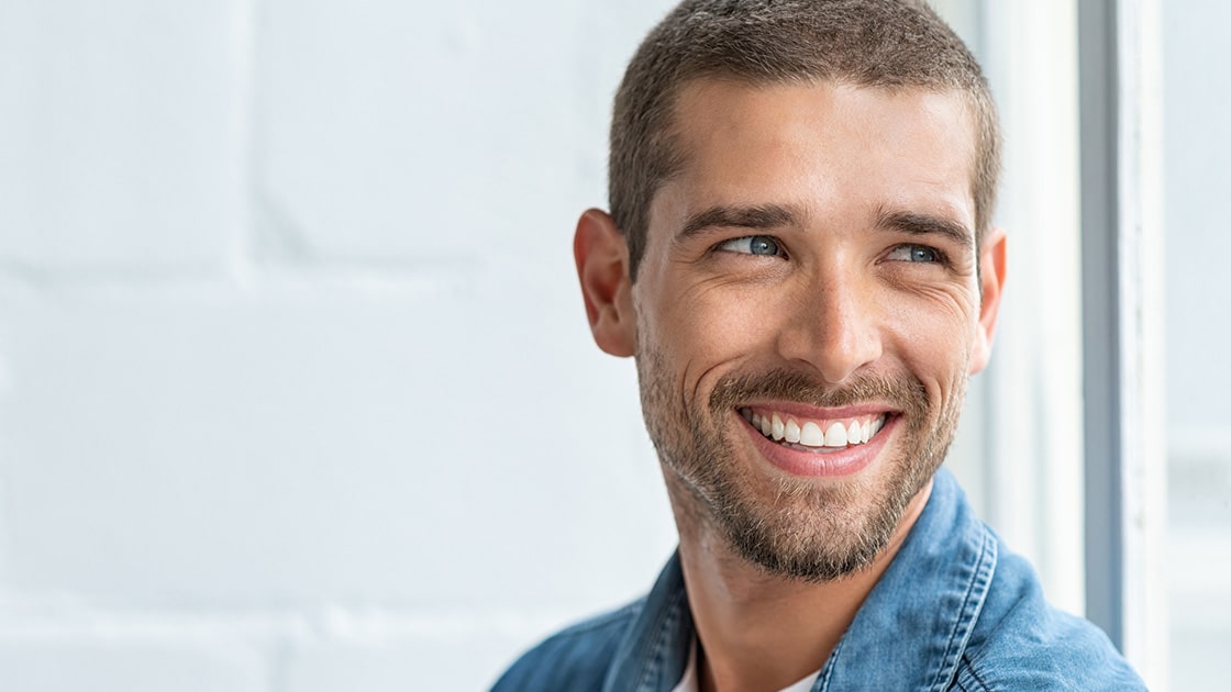 Man Smiling After Veneers