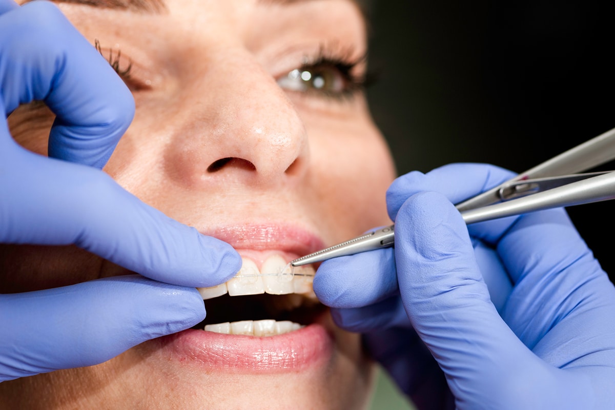 Signs your child may benefit from airway focused orthodontic treatment in delmar blog