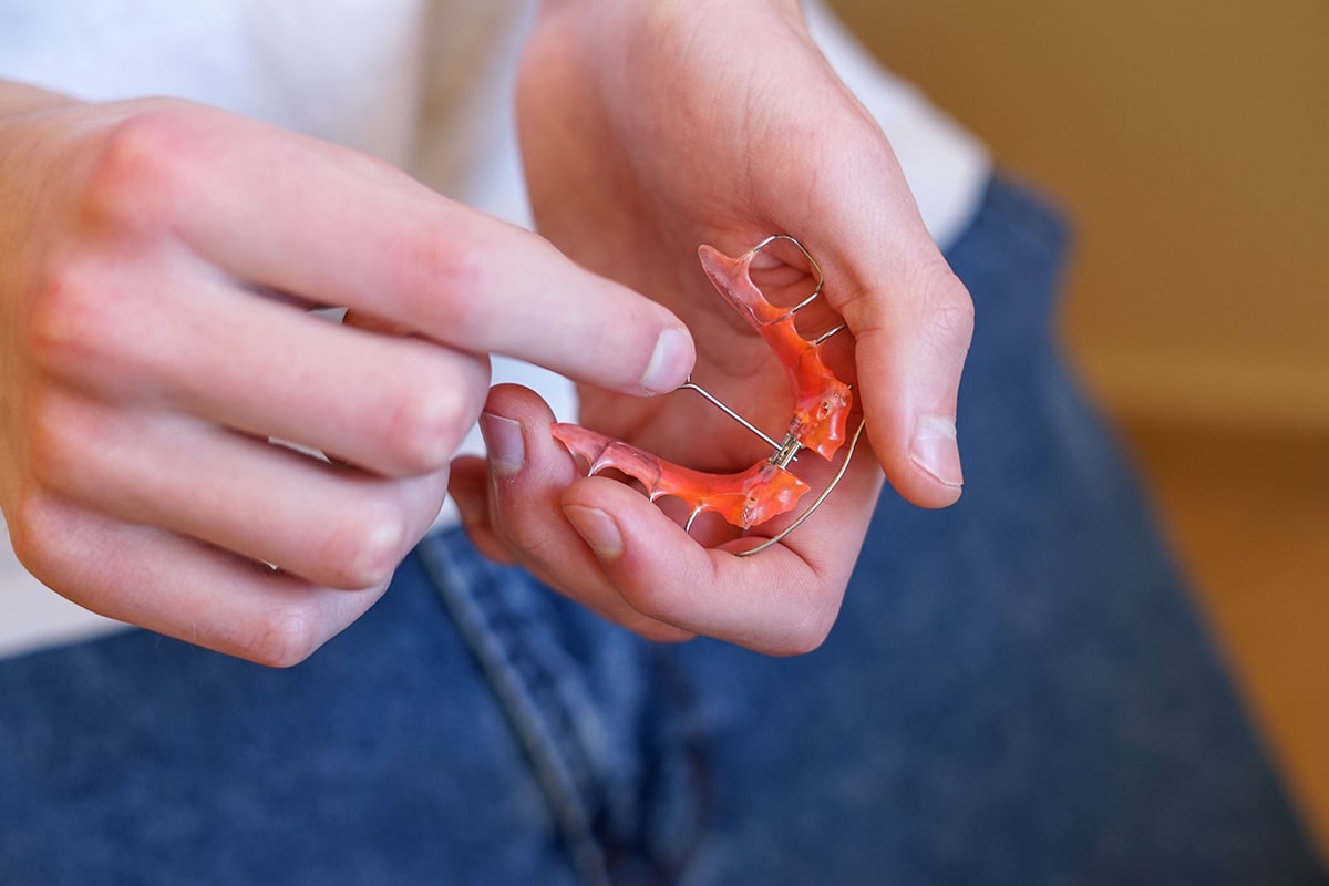 What is a palatal expander and does my child need one blog